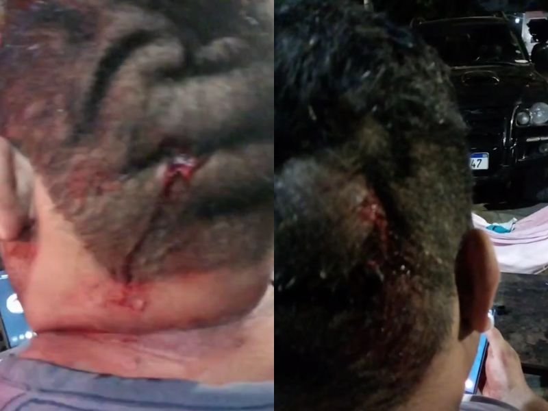 Blogueiro baleado; bala atravessou pele atrás da cabeça